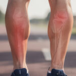 découvrez comment distinguer une périostite d'une fracture de fatigue lorsque vous ressentez des douleurs aux tibias dès les premières sorties, et apprenez les meilleures méthodes pour soulager et prévenir ces blessures.